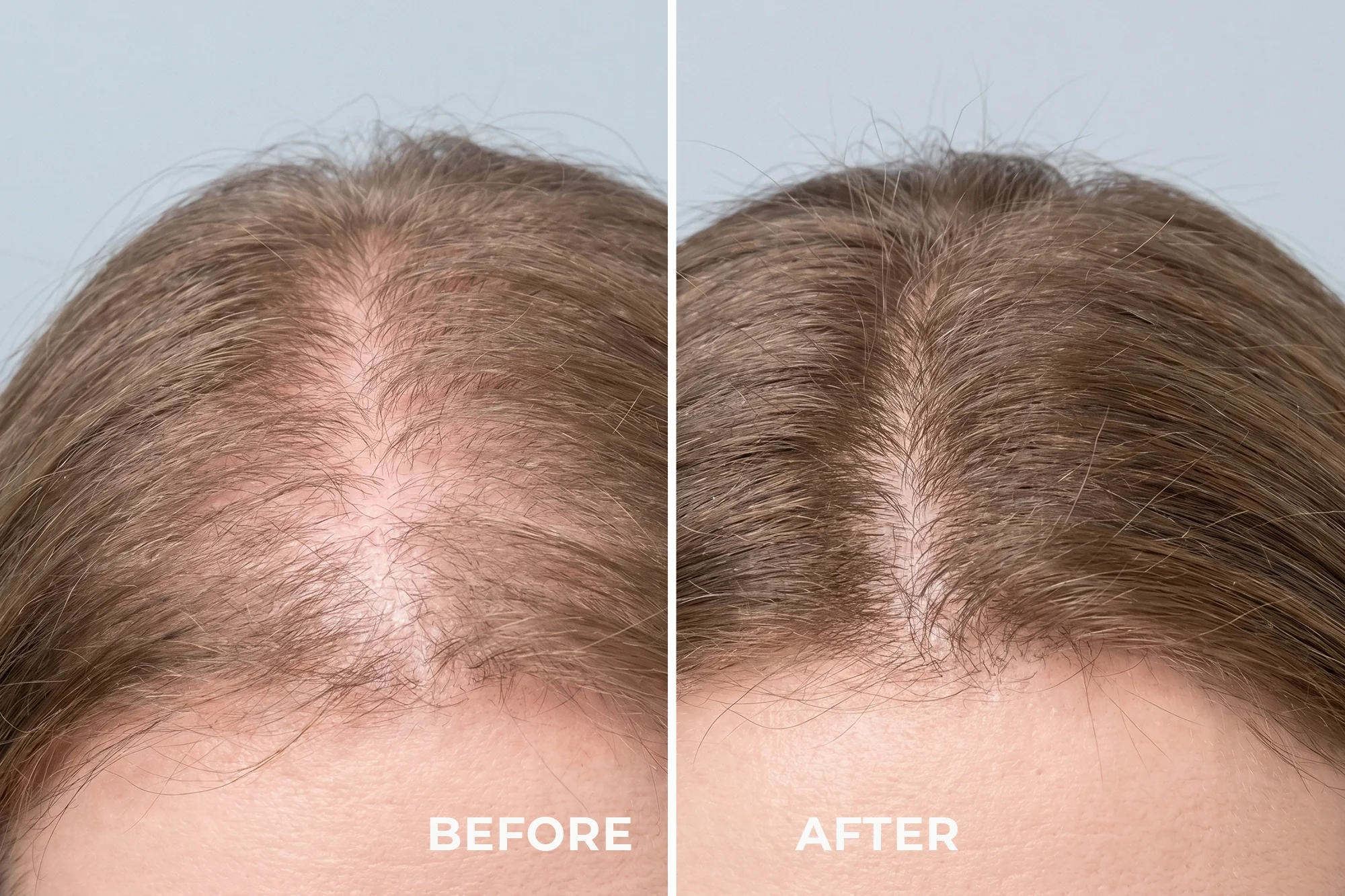 ATAMA - SCALP MASSAGER FOR HAIR GROWTH STIMULATION AND SCALP CARE - Image 3
