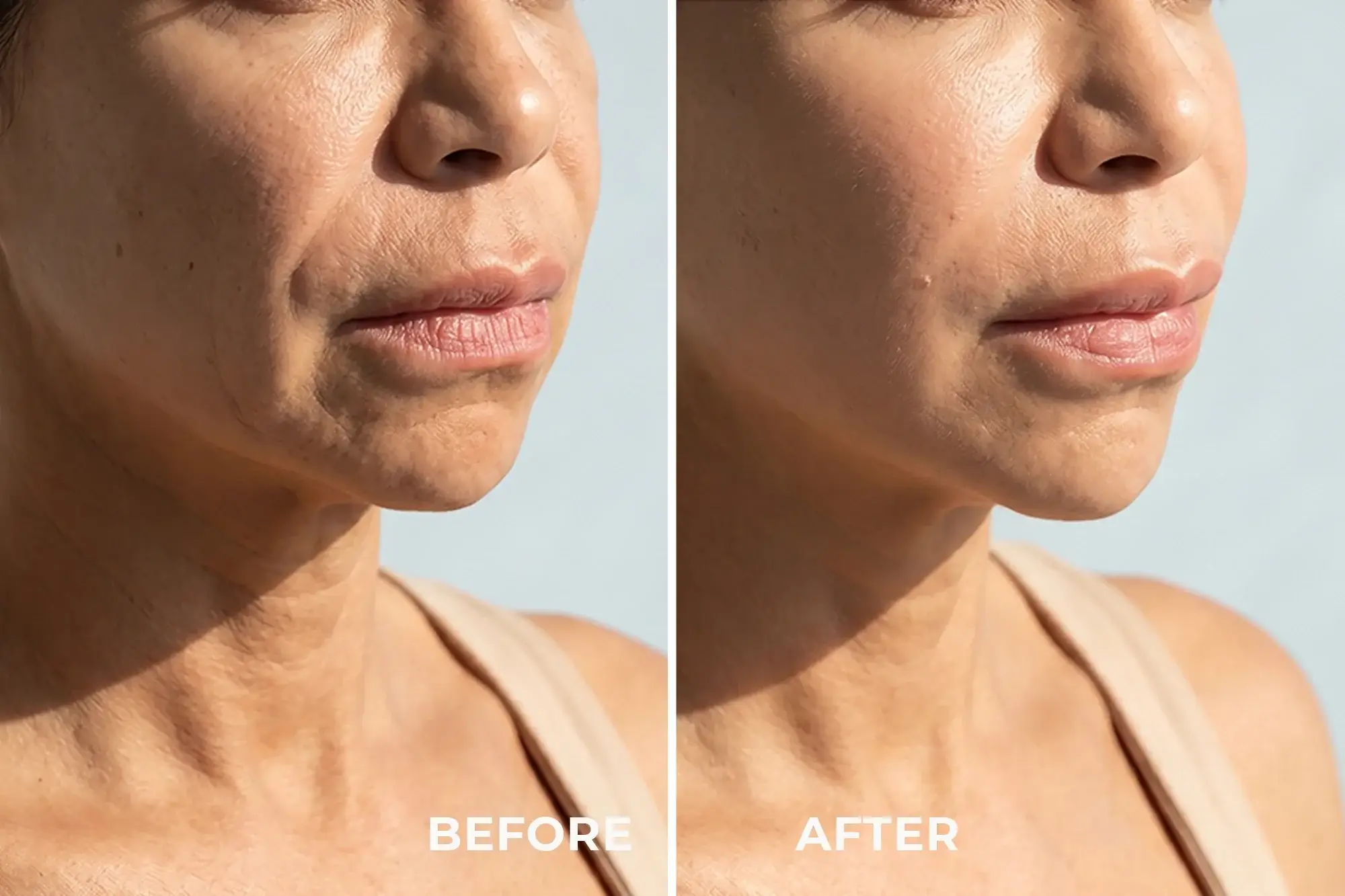 MIRA - Microcurrent anti-aging device - Image 3