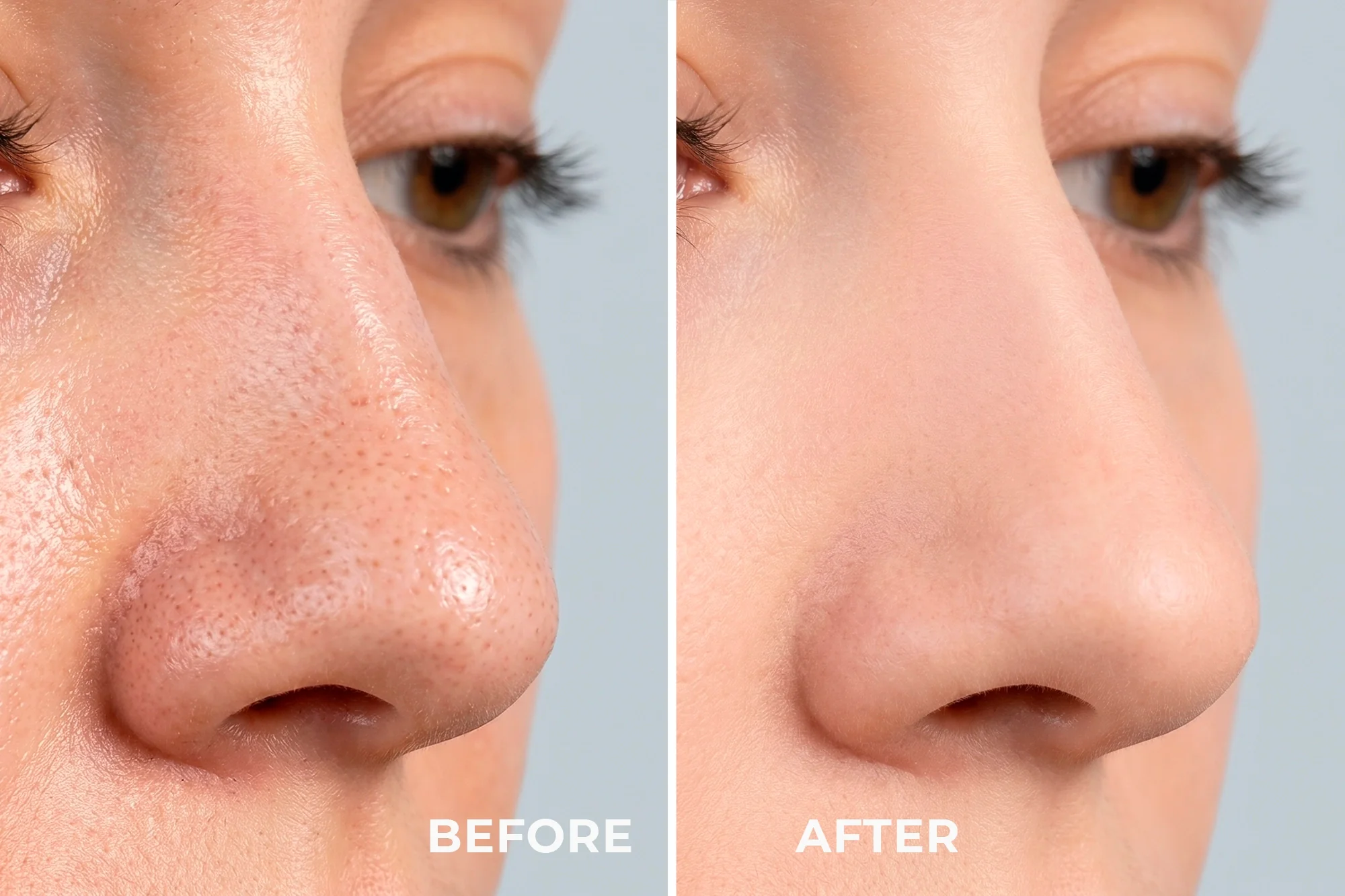 REN - Ultrasonic Facial Scrubber - Image 3